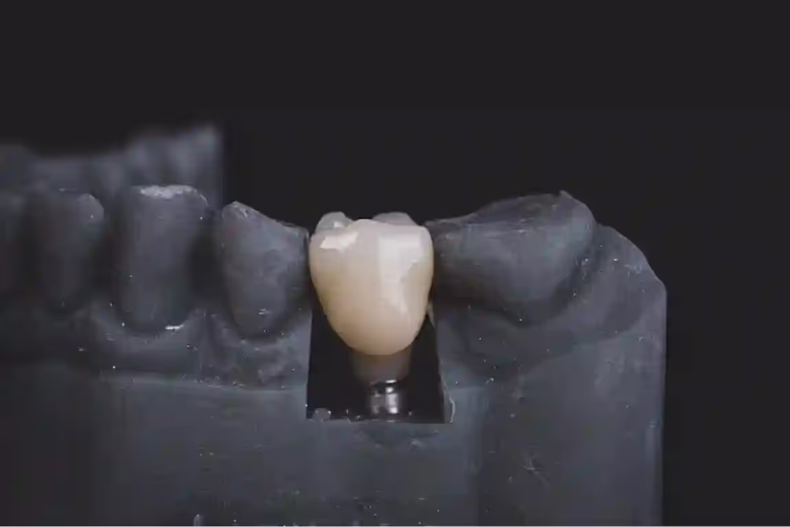 dentalimplantcost.space